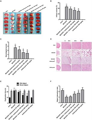 Protective Effect of Anthocyanin on Neurovascular Unit in Cerebral Ischemia/Reperfusion Injury in Rats